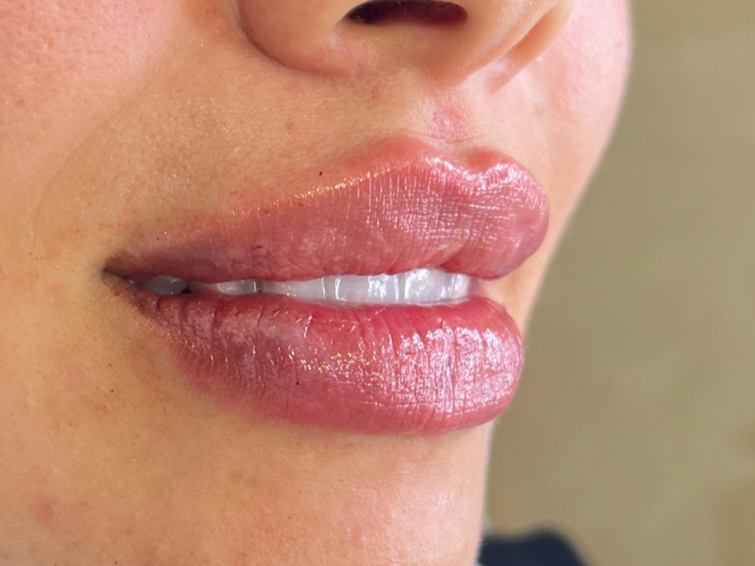 نتيجة علاج في Natour Clinic 9