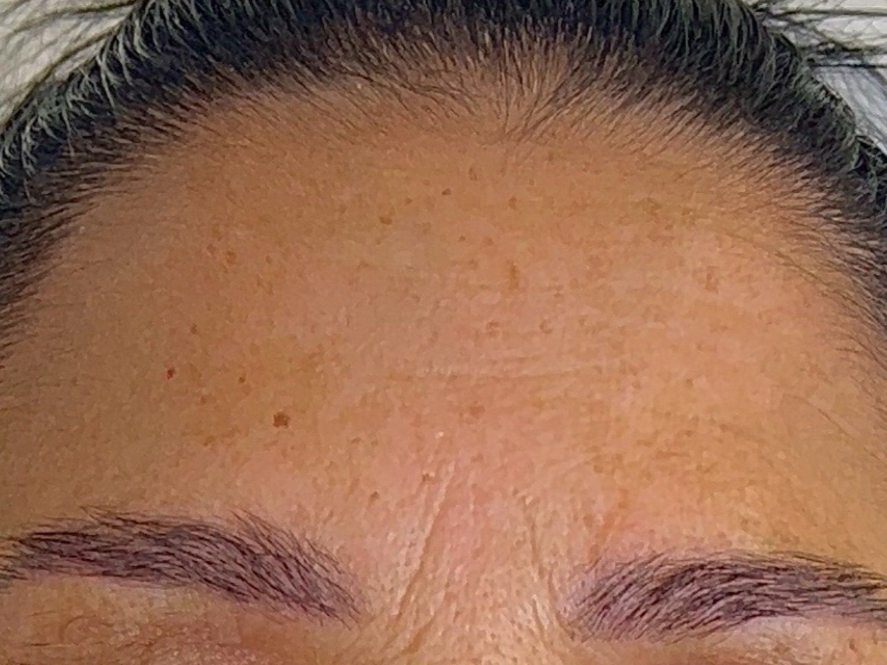 نتيجة علاج في Natour Clinic 1