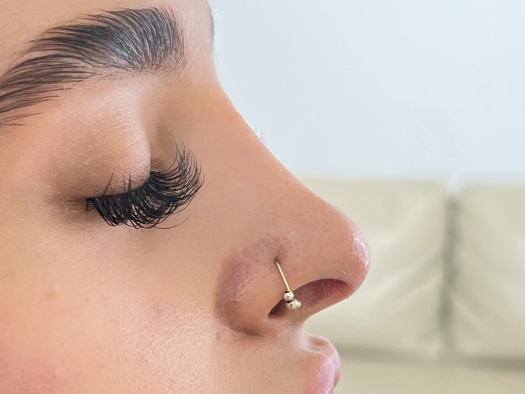 نتيجة علاج في Natour Clinic 12